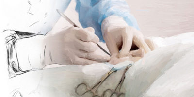 Soft Tissue Surgery II
